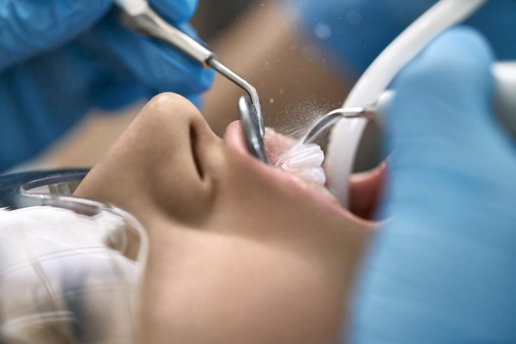 dental cleanings austin